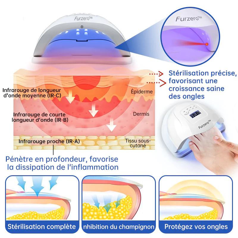 Furzero™ Le Dispositif de Thérapie Laser Antifongique - Image 9