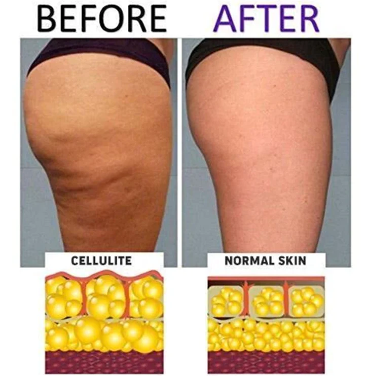 2024 Anti-Cellulite Compression High Waist Slim Leggings - Image 8