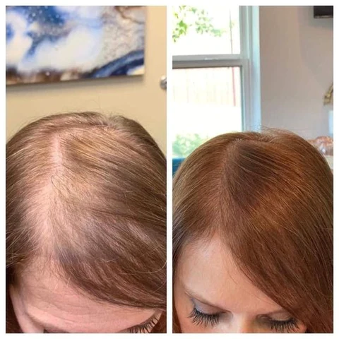 Fivfivgo™ Marokkanisches Haaröl - Image 5