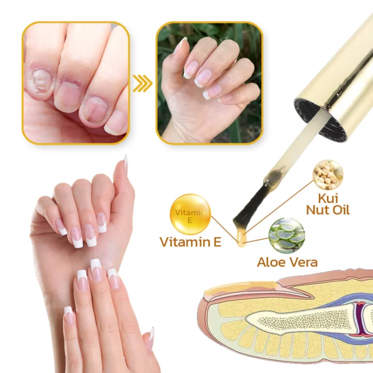 LIMETOW™ Peeling Nail Serum - Image 7