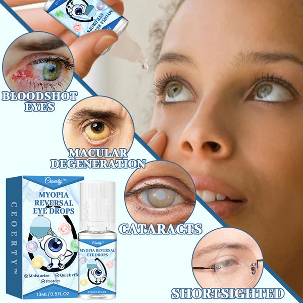 Ceoerty™ Myopia Reversal Eye Drops - Image 7
