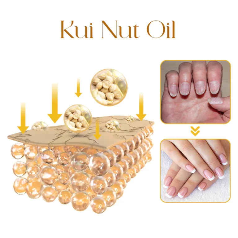 LIMETOW™ Peeling Nail Serum - Image 4