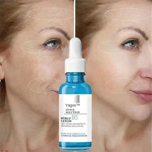 Tiworld™ Botox facial Serum - Image 5
