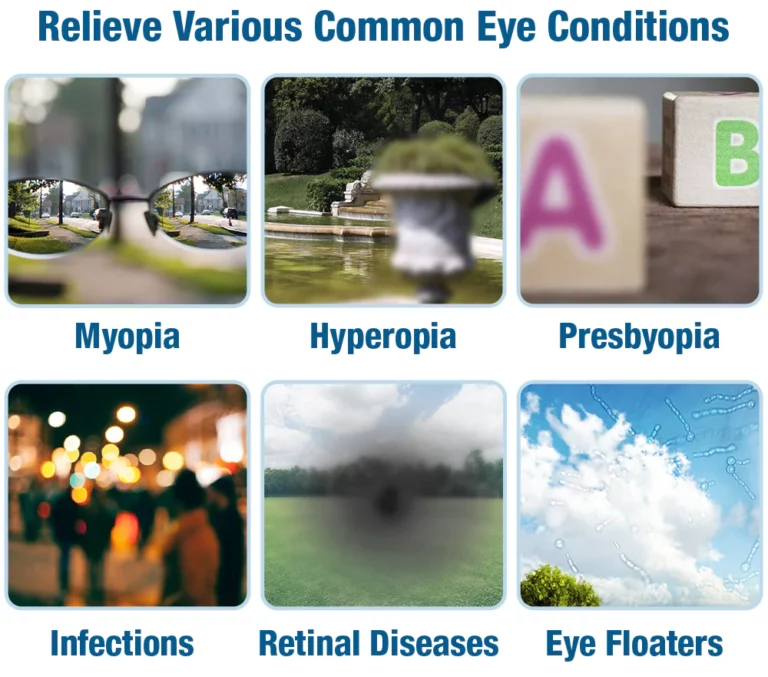 GFOUK™ OphthalTech Vision Vitality Electric Device - Image 6