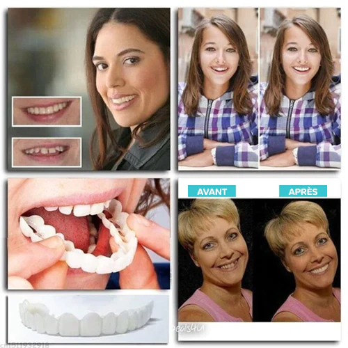 Oveallgo™ Prothèses ajustables à clipser - Image 6