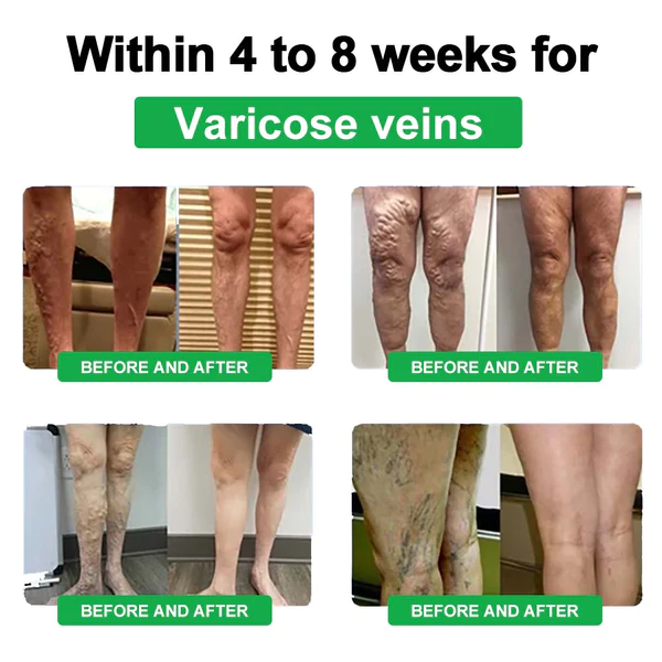 Voilaist™ Wristband-Far Infrared-Negative Ions-Energy Balance - Image 3