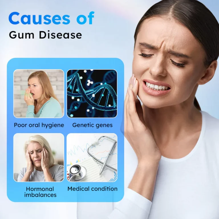 Fivfivgo™ Zahnfleischgel zur oralen Behandlung - Image 5