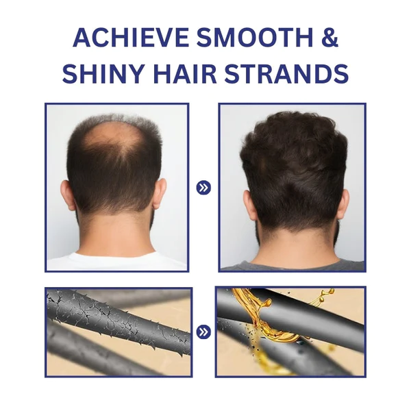 Fivfivgo™ PotentGRO Hair Treatment Roller - Image 3