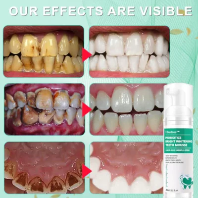 Hudros™ Herbal Brightening Oral Repair Mousse - Image 9