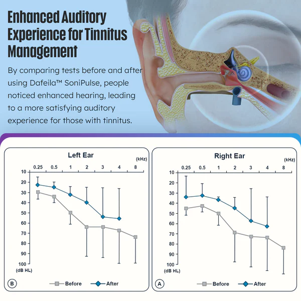 Dafeila™ SoniPulse Tinnitus Relief Soothing Aid - Image 4