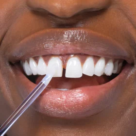 UNPREE™ NiceSmile Zahnaufhellungsessenz - Image 10