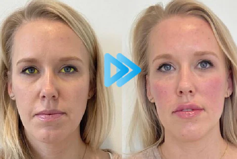 Bostore™ Myopia Reversal Eye Drops - Image 13