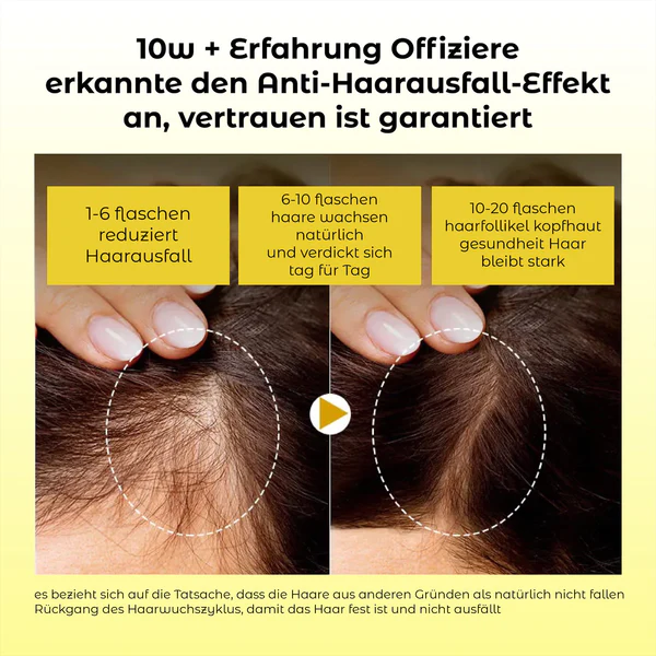ATTDX Natürliches Haarwachstums Essential Öl - Image 5
