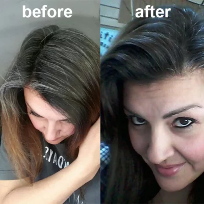 LIMETOW™ Hair Darkening Spray - Image 15