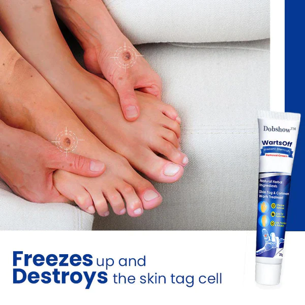 Dobshow™ WartsOff Rapid Creme zur sofortigen Entfernung von Hautunreinheiten - Image 3
