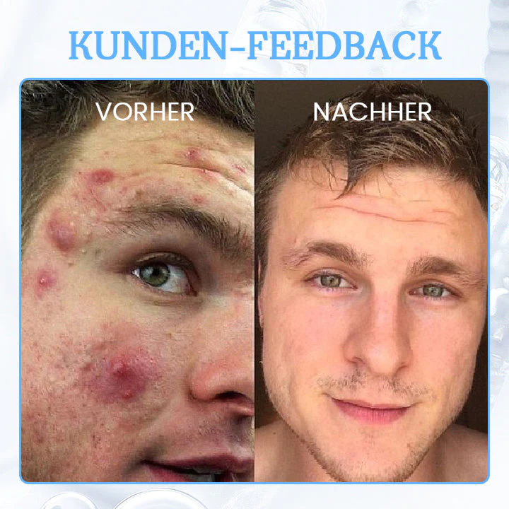 Biancat™ PoreClear 2% BHA Hauterneuerungsflüssigkeit - Image 9