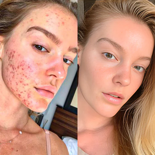 Biancat™ PoreClear 2% BHA Hauterneuerungsflüssigkeit - Image 8