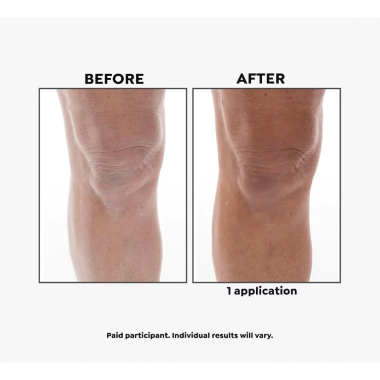 Imperial Honey Deluxe 2-piece Kit - Image 5