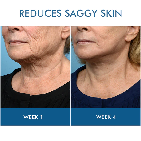 Oveallgo™ Goiterless Neck Skin Firming Serum - Image 12