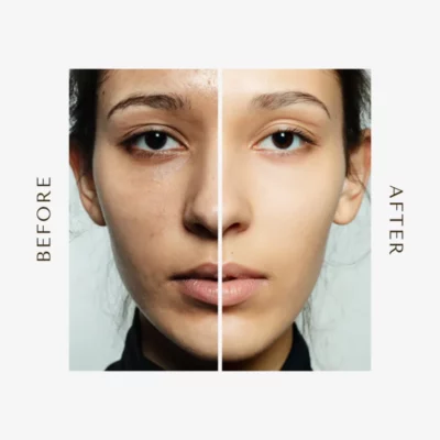 Glow Turmeric Combe Set - Image 6