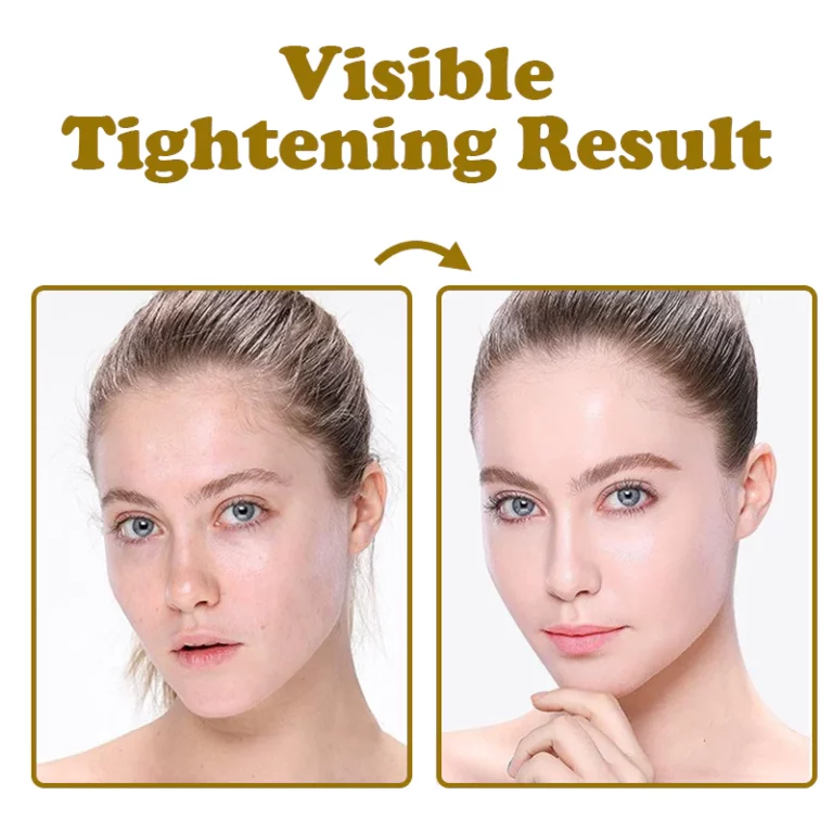 ATTDX Divine Lifting Protein Threads - Image 7