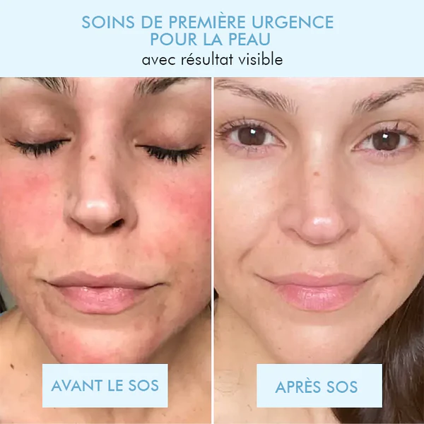 Oveallgo™ Masque Coréen Bio-Collagène Profond Réel - Image 11