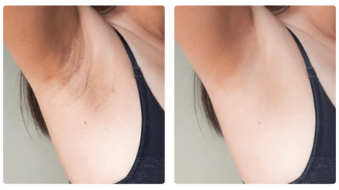 ATTDX Volcanic Mineral Absorbing Roller Stick - Image 9