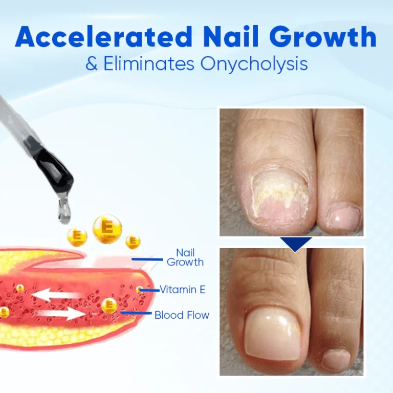 Nurbini™ OnyxoGuard Nail Growth and Repair Serum - Image 6