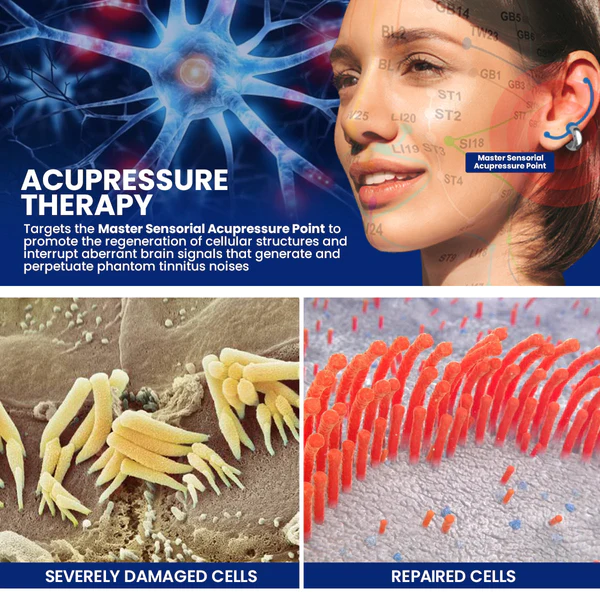 Dafeila™ Acupressure Tinnitus Relief Earring - Image 5