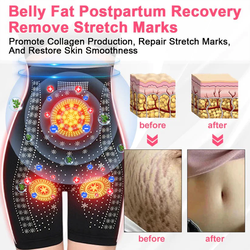 EXPECTSKY™ Negative Oxygen Ion Fat Burning Tummy Control & Detox Bodysuit - Image 11