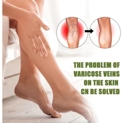 Awzlove™ Varicose Veins Spray - Image 3