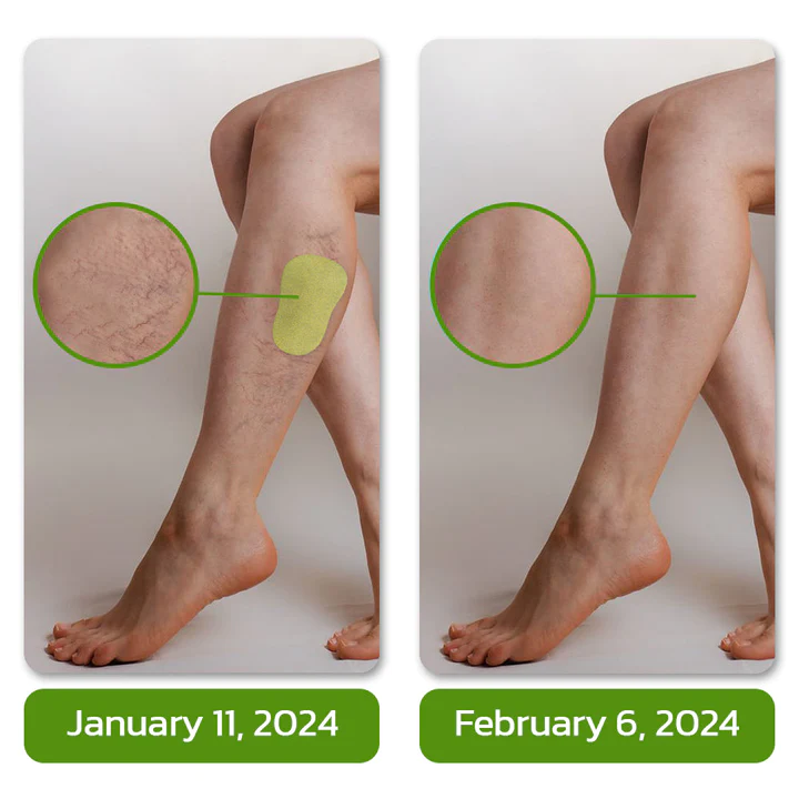 GFOUK™ NatureHeal Wormwood Purifying Pads - Image 6