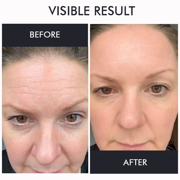 Oveallgo™ Korean Gold Seal Lifting Cream+ 2-in-1 Red Light / EMS Therapy Device SET - Image 11