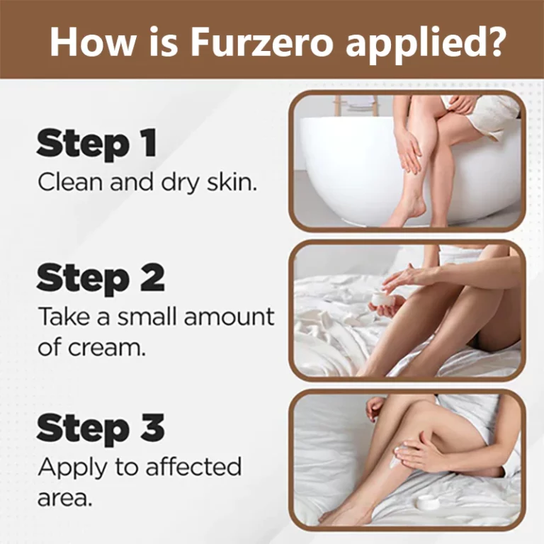 Furzero™ Bees Venom Varicose Veins Cream - Image 6