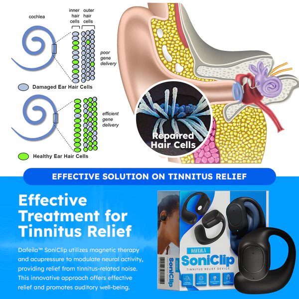 Dafeila™ SoniClip Tinnitus Relief Device - Image 5