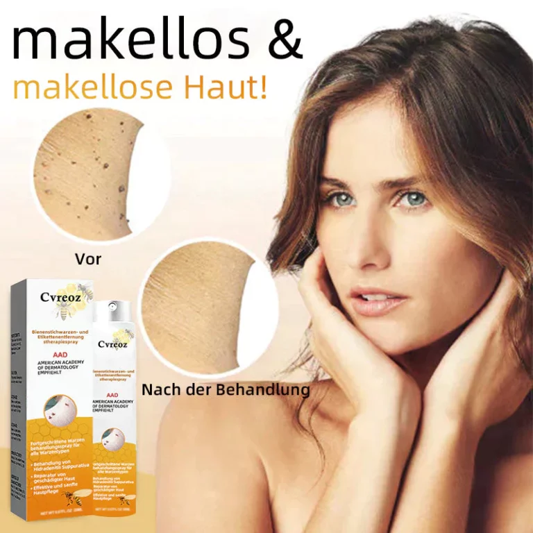 Ourlyard™ Biene Venom Wart und Tags Entfernung Behandlung Spray - Image 8