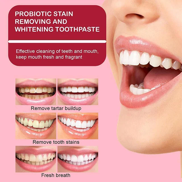 Dr. Smile SP-4TM Probiotic Rapid Whitening Toothpaste - Image 5