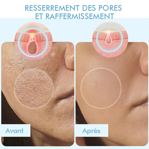 Oveallgo™ Masque Coréen Bio-Collagène Profond Réel - Image 9
