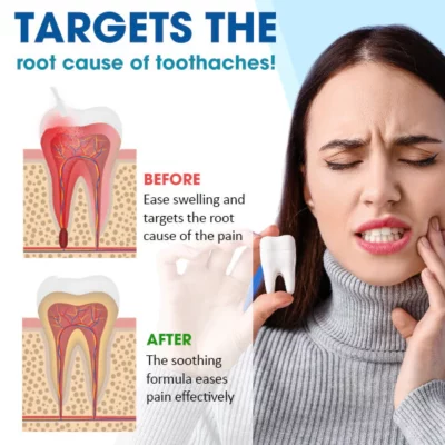 UNPREE™ Tooth Relief Spray - Image 3