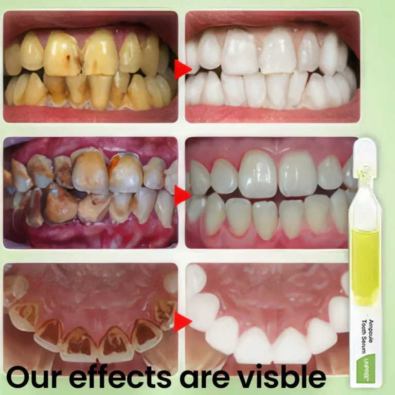 UNPREE™ Ampoule Tooth Serum - Image 7