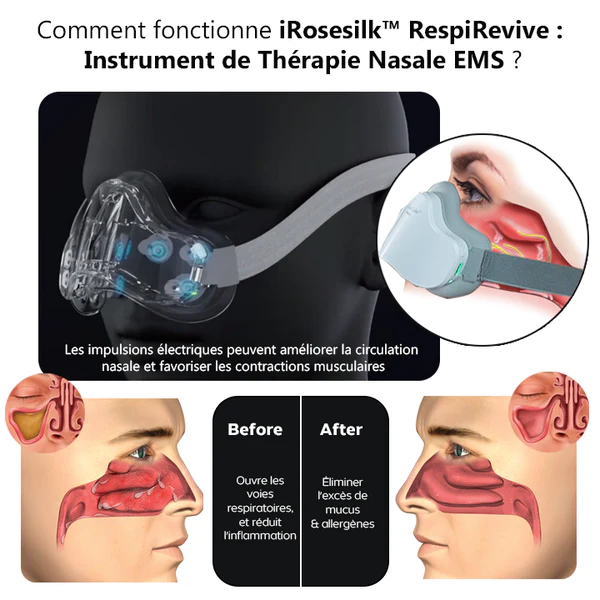 iRosesilk™ RespiRevive EMS Nasaltherapie-Instrument - Image 5