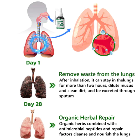 AAFQ™ Organic Herbal Lung Repair Nasal Spray - Image 7