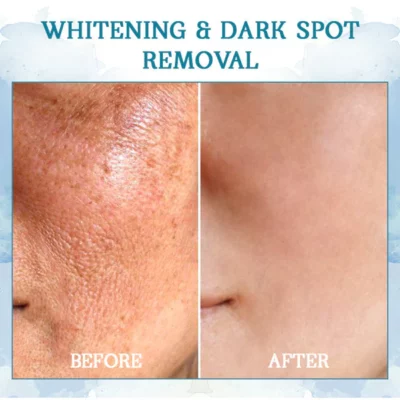 Oveallgo™ LuxeLift hautstraffende Jugendbutter - Image 3