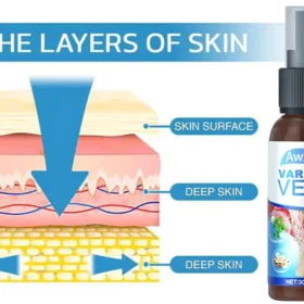Awzlove™ Varicose Veins Spray - Image 4