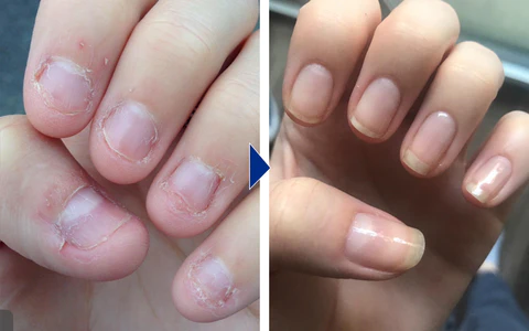 Nurbini™ OnyxoGuard Nail Growth and Repair Serum - Image 8