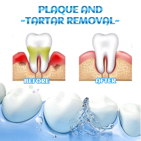 Dobshow™ SmileBright Mousse - Image 3
