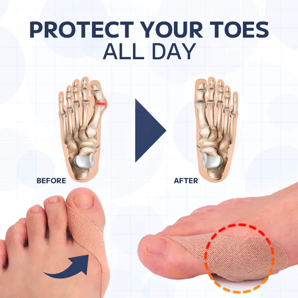 Furzero™ Toe Corrector Composite Patch - Image 9