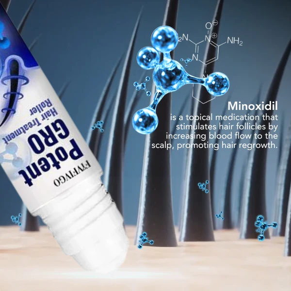 Fivfivgo™ PotentGRO Hair Treatment Roller - Image 6