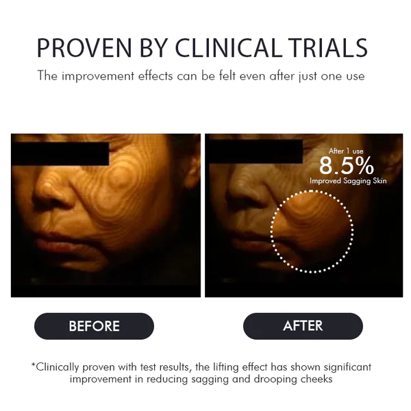 Oveallgo™ Korean Gold Seal Lifting Cream+ 2-in-1 Red Light / EMS Therapy Device SET - Image 10