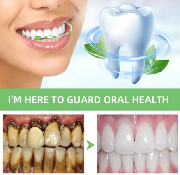 Fivfivgo™ Kräuter Aufhellung Mündlich Reparatur-Mousse - Image 7